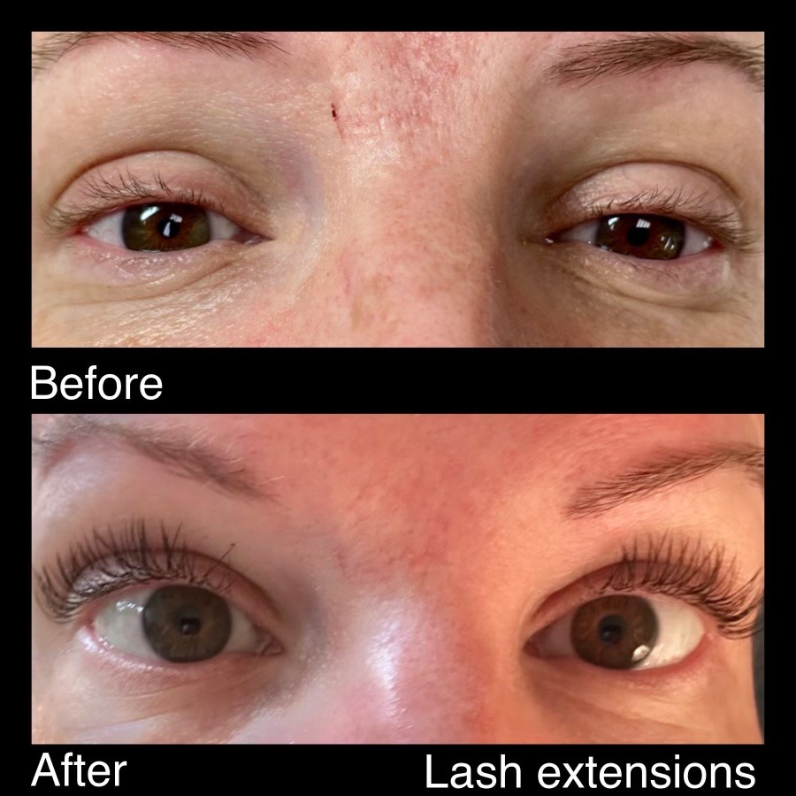 Lash Extensions Before And After