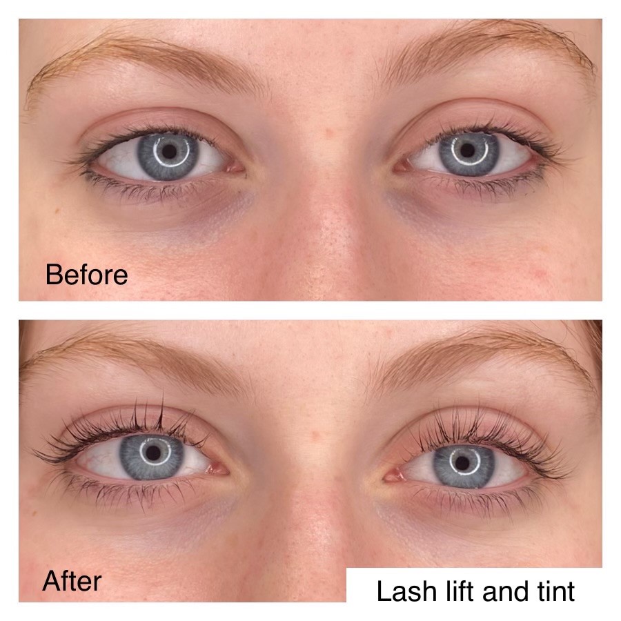 Lash Lift And Tint Before And After