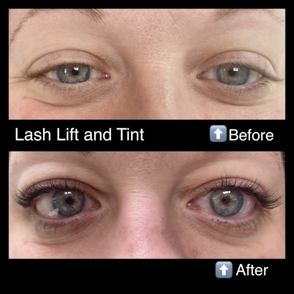 Medica Spa In Nixa Missouri Before After Lash Lift Tint