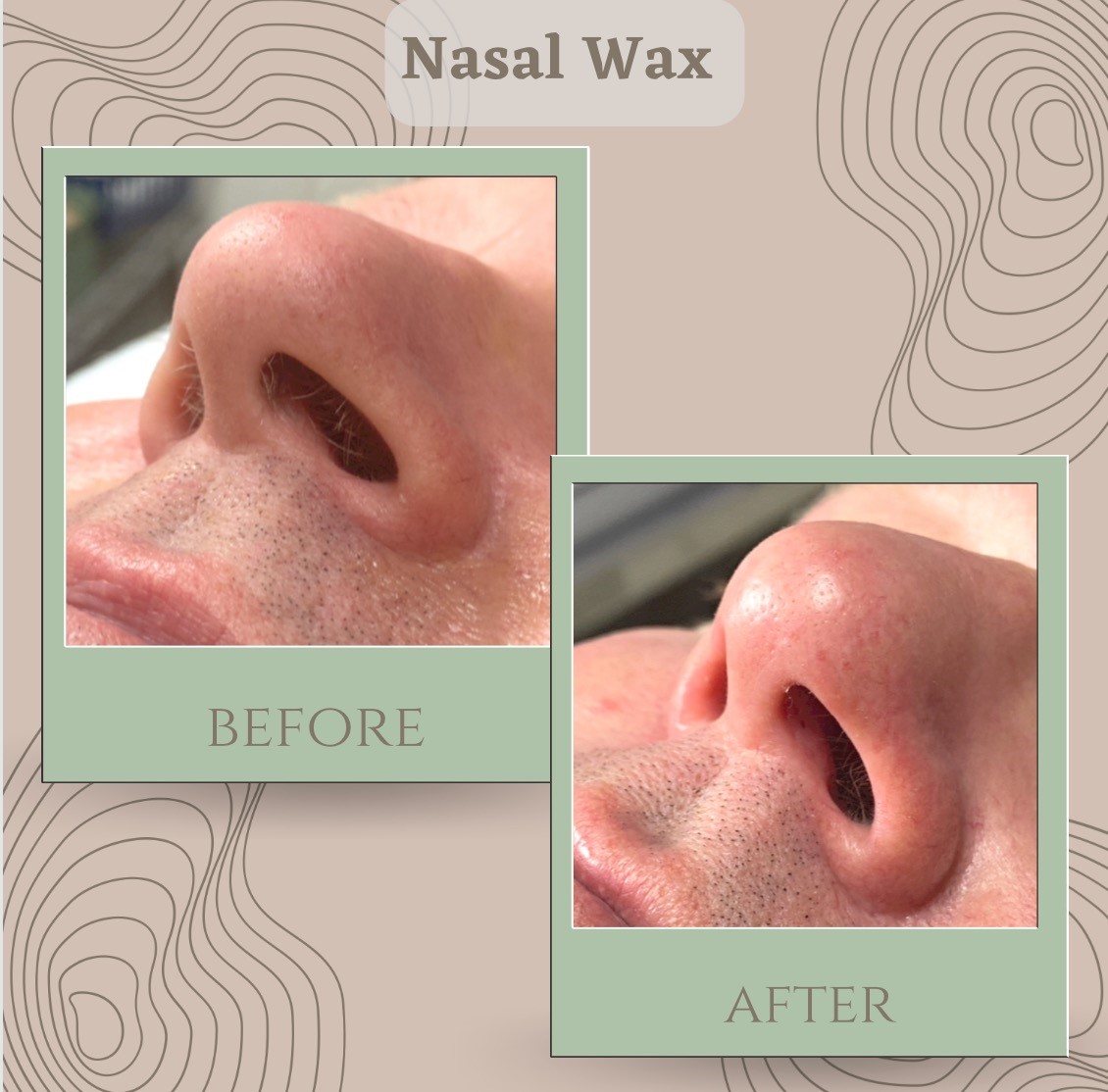 Nasal Wax Before And After